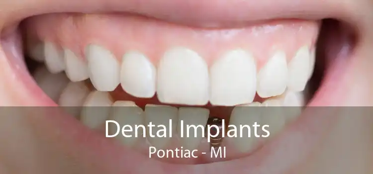 Dental Implants Pontiac - MI