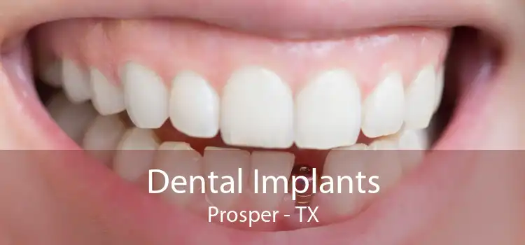 Dental Implants Prosper - TX