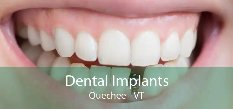 Dental Implants Quechee - VT