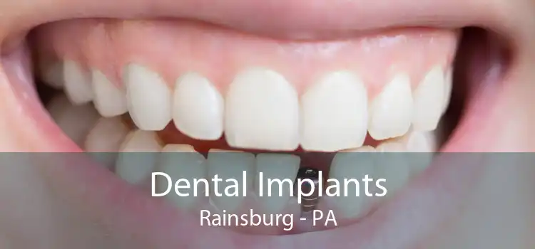 Dental Implants Rainsburg - PA
