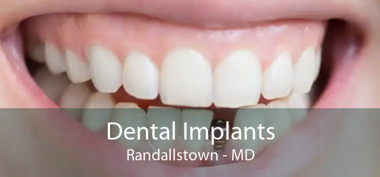 Dental Implants Randallstown - MD