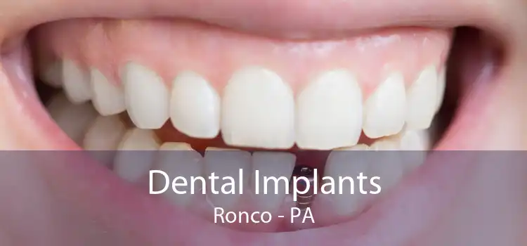 Dental Implants Ronco - PA