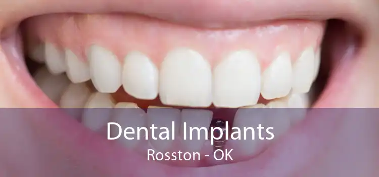 Dental Implants Rosston - OK