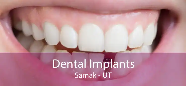 Dental Implants Samak - UT