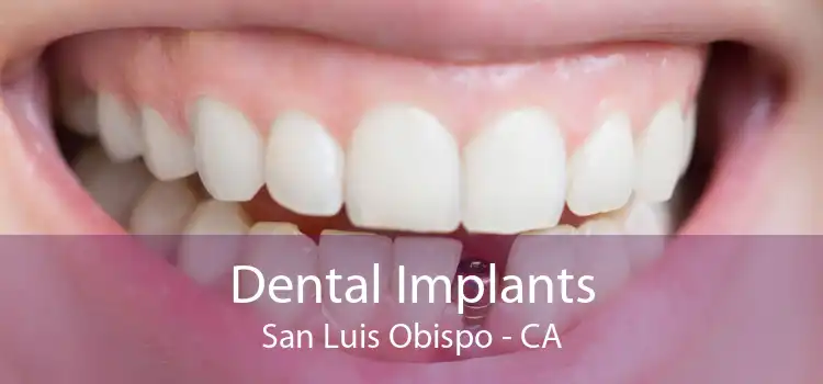 Dental Implants San Luis Obispo - CA