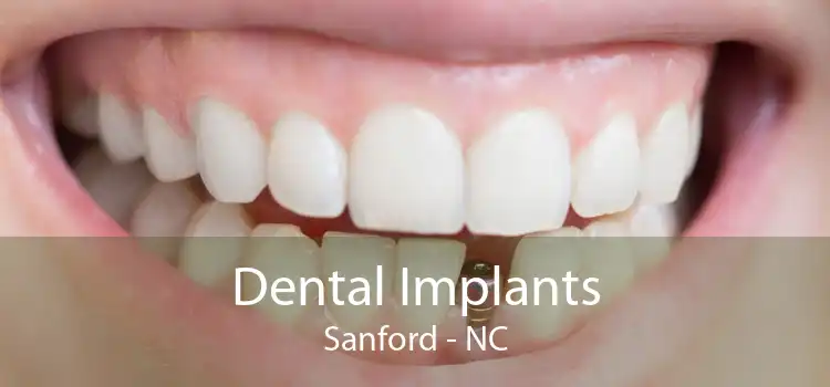 Dental Implants Sanford - NC