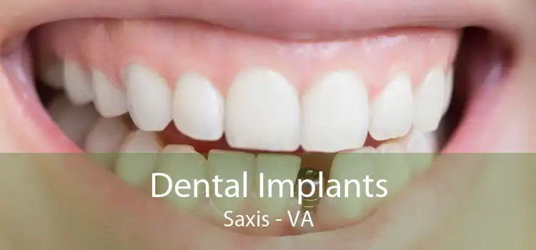 Dental Implants Saxis - VA