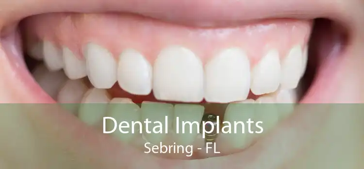 Dental Implants Sebring - FL