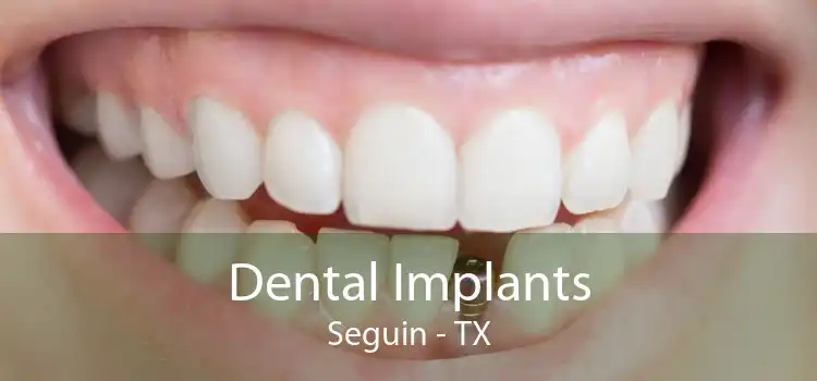 Dental Implants Seguin - TX
