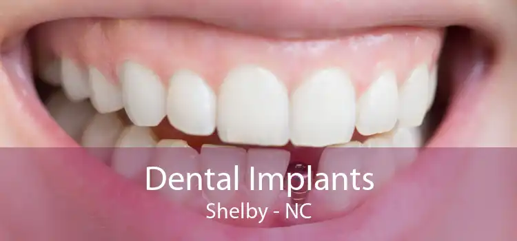 Dental Implants Shelby - NC
