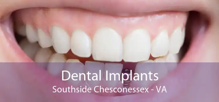 Dental Implants Southside Chesconessex - VA