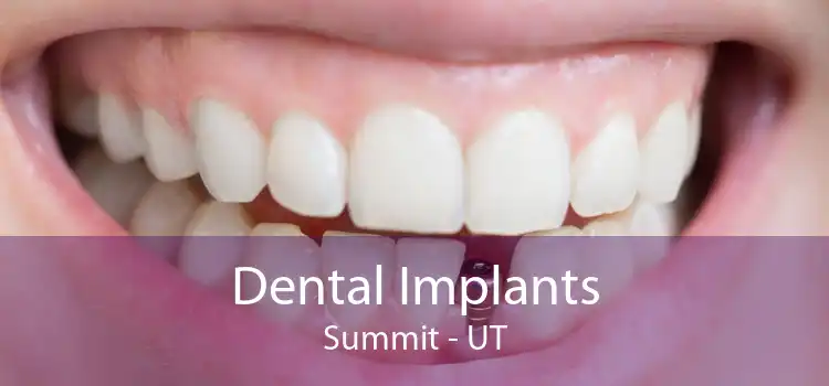 Dental Implants Summit - UT