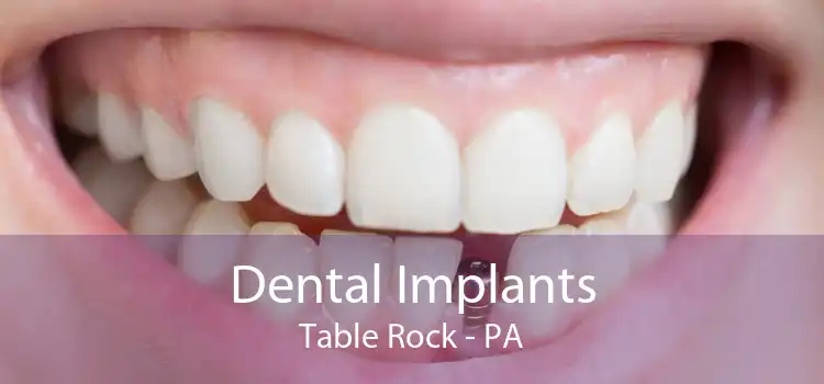 Dental Implants Table Rock - PA