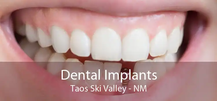Dental Implants Taos Ski Valley - NM