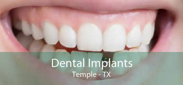 Dental Implants Temple - TX