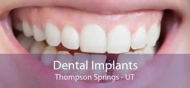 Dental Implants Thompson Springs - UT