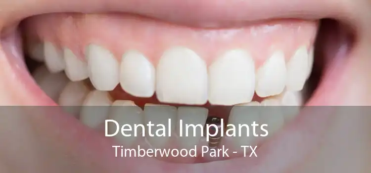 Dental Implants Timberwood Park - TX