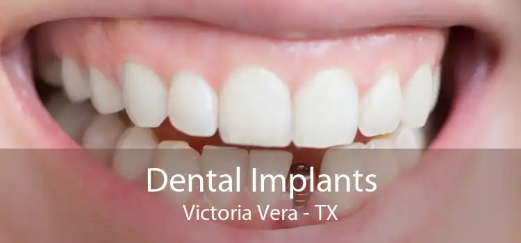 Dental Implants Victoria Vera - TX