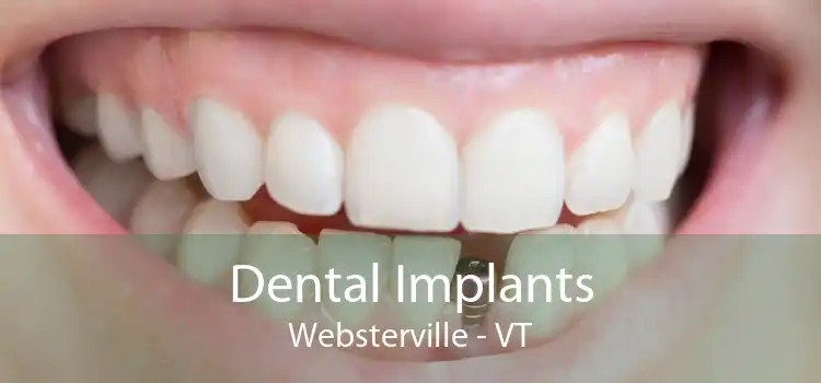 Dental Implants Websterville - VT