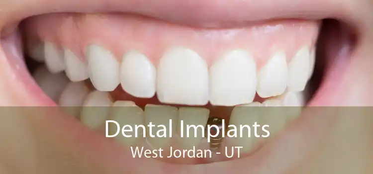 Dental Implants West Jordan - UT