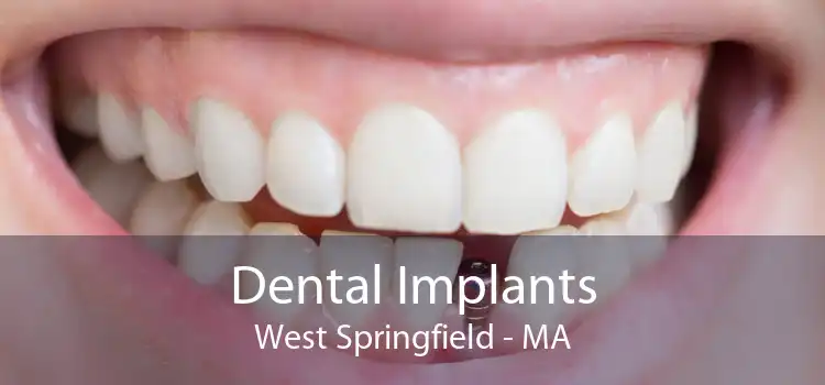 Dental Implants West Springfield - MA