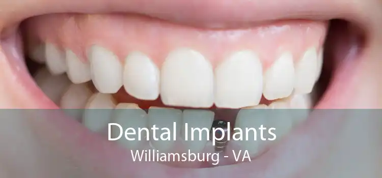 Dental Implants Williamsburg - VA