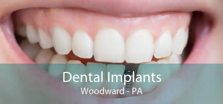 Dental Implants Woodward - PA