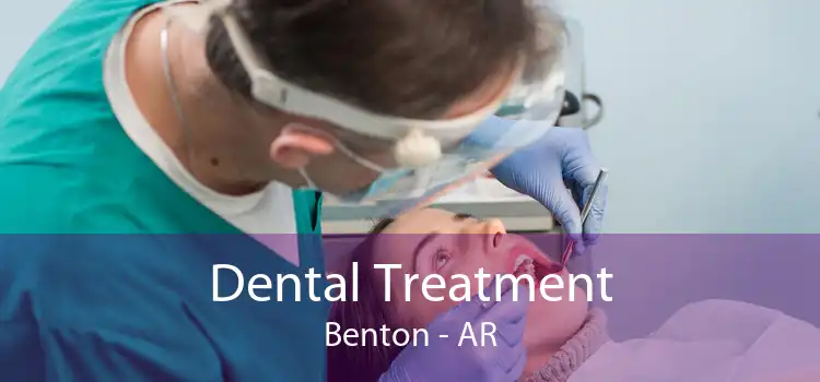 Dental Treatment Benton - AR