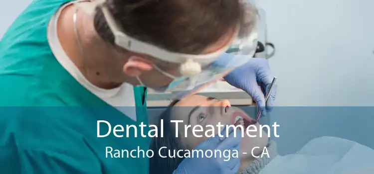 Dental Treatment Rancho Cucamonga - CA