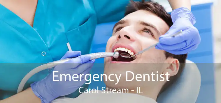 Emergency Dentist Carol Stream - IL