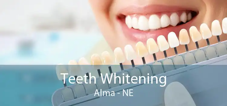 Teeth Whitening Alma - NE