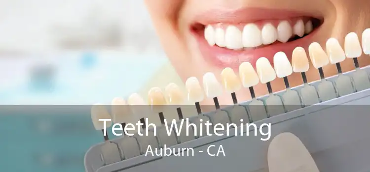 Teeth Whitening Auburn - CA