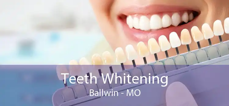 Teeth Whitening Ballwin - MO