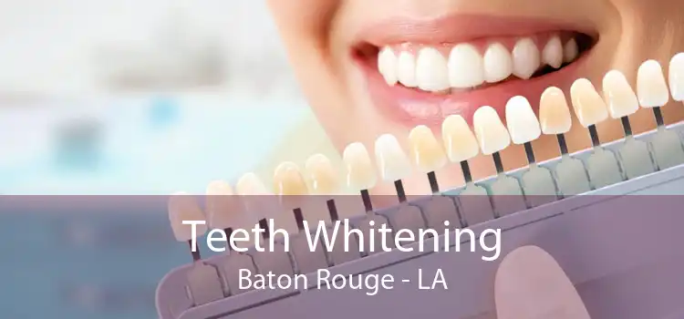 Teeth Whitening Baton Rouge - LA