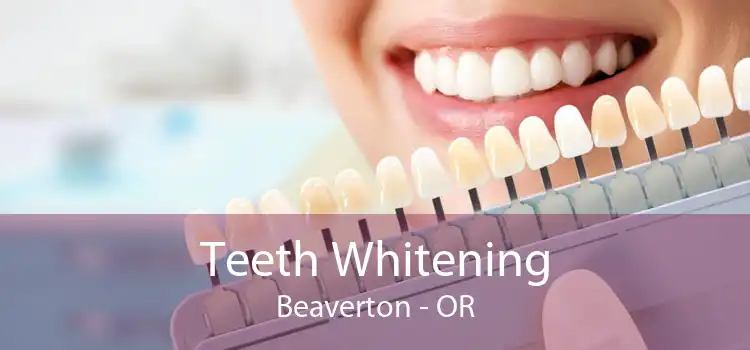 Teeth Whitening Beaverton - OR