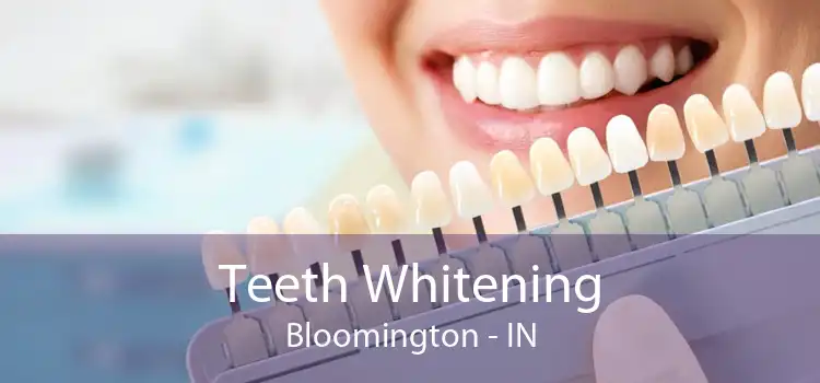Teeth Whitening Bloomington - IN