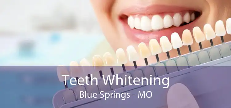 Teeth Whitening Blue Springs - MO
