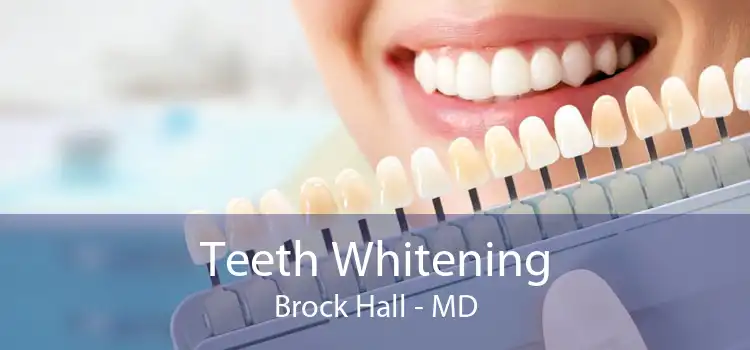 Teeth Whitening Brock Hall - MD