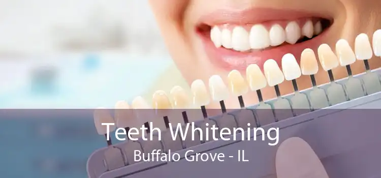 Teeth Whitening Buffalo Grove - IL