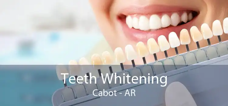 Teeth Whitening Cabot - AR