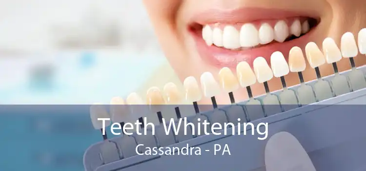 Teeth Whitening Cassandra - PA