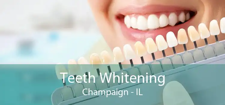 Teeth Whitening Champaign - IL