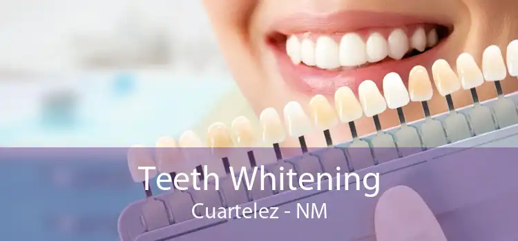 Teeth Whitening Cuartelez - NM