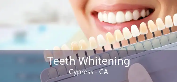 Teeth Whitening Cypress - CA