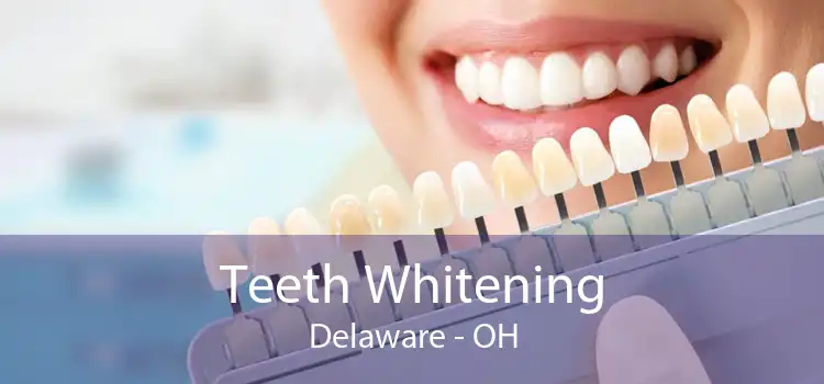 Teeth Whitening Delaware - OH