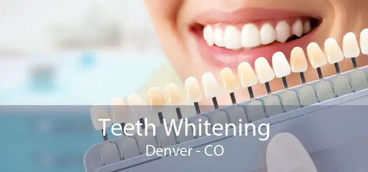Teeth Whitening Denver - CO