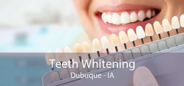 Teeth Whitening Dubuque - IA