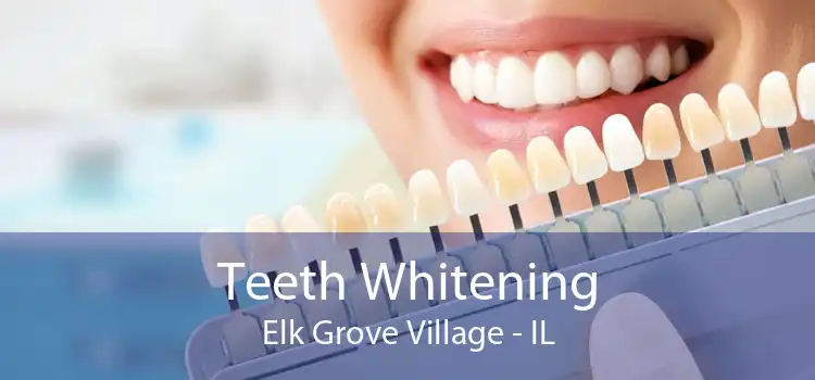 Teeth Whitening Elk Grove Village - IL