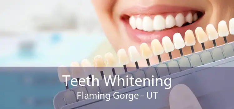 Teeth Whitening Flaming Gorge - UT