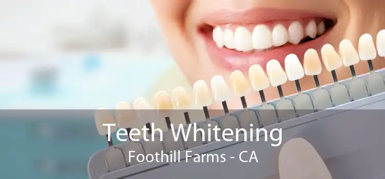 Teeth Whitening Foothill Farms - CA
